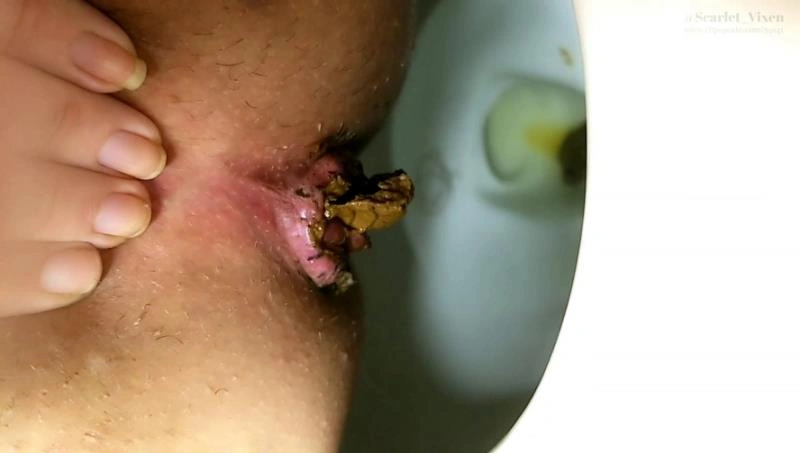 ChunkyMonkey Soft Serve Shit AKinkyVixen [FullHD/2026]